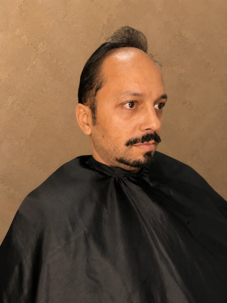 Cliente antes da prótese capilar, com falhas visíveis e expressão séria em perfil.